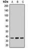 Ribose-phosphate pyrophosphokinase 1 antibody, LS-C668011, Lifespan Biosciences, Western Blot image 