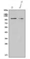 Transient Receptor Potential Cation Channel Subfamily C Member 3 antibody, A01472-4, Boster Biological Technology, Western Blot image 