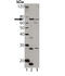 Transporter 1, ATP Binding Cassette Subfamily B Member antibody, A01123, Boster Biological Technology, Western Blot image 