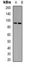 Leukocyte Receptor Tyrosine Kinase antibody, orb318775, Biorbyt, Western Blot image 