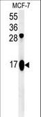 ATP Synthase Membrane Subunit F antibody, LS-C156661, Lifespan Biosciences, Western Blot image 