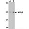 Nuclear Receptor Subfamily 1 Group H Member 2 antibody, MBS150709, MyBioSource, Western Blot image 