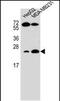 Ras Homolog Family Member J antibody, PA5-48271, Invitrogen Antibodies, Western Blot image 