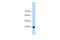 Heterogeneous nuclear ribonucleoprotein A/B antibody, A07146, Boster Biological Technology, Western Blot image 