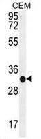Beta-1,3-Glucuronyltransferase 3 antibody, AP50327PU-N, Origene, Western Blot image 
