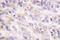 Spleen Associated Tyrosine Kinase antibody, LS-C176226, Lifespan Biosciences, Immunohistochemistry frozen image 