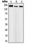 Sodium Voltage-Gated Channel Alpha Subunit 1 antibody, LS-C352820, Lifespan Biosciences, Western Blot image 