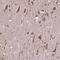 Importin 11 antibody, HPA067097, Atlas Antibodies, Immunohistochemistry frozen image 