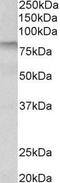 Transglutaminase 3 antibody, PA5-37896, Invitrogen Antibodies, Western Blot image 