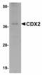 Caudal Type Homeobox 2 antibody, LS-B9509, Lifespan Biosciences, Western Blot image 