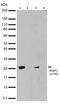 Eukaryotic Translation Initiation Factor 4E Binding Protein 1 antibody, 710323, Invitrogen Antibodies, Western Blot image 
