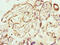 Protein Phosphatase With EF-Hand Domain 1 antibody, CSB-PA018435LA01HU, Cusabio, Immunohistochemistry paraffin image 