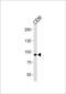 Matrilin 2 antibody, LS-C203964, Lifespan Biosciences, Western Blot image 