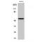 Aldehyde Dehydrogenase 1 Family Member B1 antibody, LS-C381971, Lifespan Biosciences, Western Blot image 