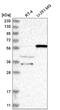 Nuclear Receptor Binding Protein 2 antibody, NBP2-58227, Novus Biologicals, Western Blot image 