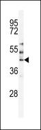 Serine/Threonine Kinase 24 antibody, 63-290, ProSci, Western Blot image 