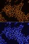 THAP Domain Containing 11 antibody, MAB5727, R&D Systems, Immunocytochemistry image 