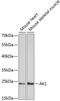 Adenylate Kinase 1 antibody, GTX30037, GeneTex, Western Blot image 