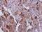 Ubiquitin Conjugating Enzyme E2 T antibody, GTX106464, GeneTex, Immunohistochemistry paraffin image 