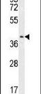 Cytidine/Uridine Monophosphate Kinase 2 antibody, PA5-25130, Invitrogen Antibodies, Western Blot image 