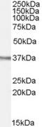 Aph-1 Homolog A, Gamma-Secretase Subunit antibody, 45-262, ProSci, Western Blot image 