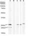 V-Set Domain Containing T Cell Activation Inhibitor 1 antibody, NBP1-06096, Novus Biologicals, Western Blot image 