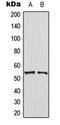 Phosphatase And Tensin Homolog antibody, orb223991, Biorbyt, Western Blot image 