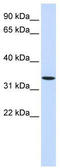 Wnt Family Member 6 antibody, TA341844, Origene, Western Blot image 