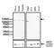 DNA Methyltransferase 3 Alpha antibody, PA1-882, Invitrogen Antibodies, Western Blot image 