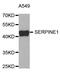 Serpin Family E Member 1 antibody, MBS129931, MyBioSource, Western Blot image 