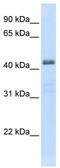 Solute Carrier Family 29 Member 2 antibody, TA334057, Origene, Western Blot image 