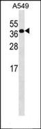 Component Of Inhibitor Of Nuclear Factor Kappa B Kinase Complex antibody, orb304723, Biorbyt, Western Blot image 