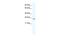 BRF1 RNA Polymerase III Transcription Initiation Factor Subunit antibody, PA5-68865, Invitrogen Antibodies, Western Blot image 