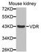 Vitamin D Receptor antibody, MBS127530, MyBioSource, Western Blot image 