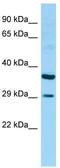 Retinoic acid early transcript 1G protein antibody, TA338350, Origene, Western Blot image 