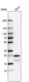 Transmembrane Protein 35A antibody, PA5-61774, Invitrogen Antibodies, Western Blot image 