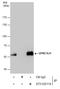 Dynein Cytoplasmic 1 Light Intermediate Chain 1 antibody, GTX120114, GeneTex, Immunoprecipitation image 