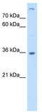 Lectin, Mannose Binding 2 antibody, TA341863, Origene, Western Blot image 