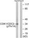 Cyclin Dependent Kinase 1 antibody, abx012435, Abbexa, Western Blot image 
