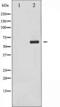 Checkpoint Kinase 2 antibody, TA325375, Origene, Western Blot image 