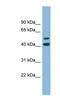 Ankyrin repeat and MYND domain-containing protein 2 antibody, NBP1-55412, Novus Biologicals, Western Blot image 