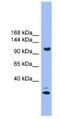 StAR Related Lipid Transfer Domain Containing 8 antibody, NBP1-69097, Novus Biologicals, Western Blot image 