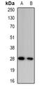 Granzyme A antibody, orb382474, Biorbyt, Western Blot image 
