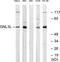 Guanine nucleotide-binding protein-like 3-like protein antibody, TA315530, Origene, Western Blot image 