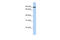 Twinkle protein, mitochondrial antibody, 25-359, ProSci, Enzyme Linked Immunosorbent Assay image 