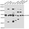 Acyl-CoA Dehydrogenase Family Member 9 antibody, STJ110108, St John