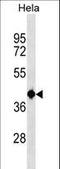 tRNA-splicing endonuclease subunit Sen2 antibody, LS-C157287, Lifespan Biosciences, Western Blot image 