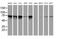 Transferrin Receptor 2 antibody, MA5-25928, Invitrogen Antibodies, Western Blot image 