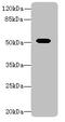 Aldehyde Dehydrogenase 1 Family Member A1 antibody, A58046-100, Epigentek, Western Blot image 