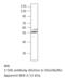 Branched Chain Keto Acid Dehydrogenase Kinase antibody, MBS540420, MyBioSource, Western Blot image 